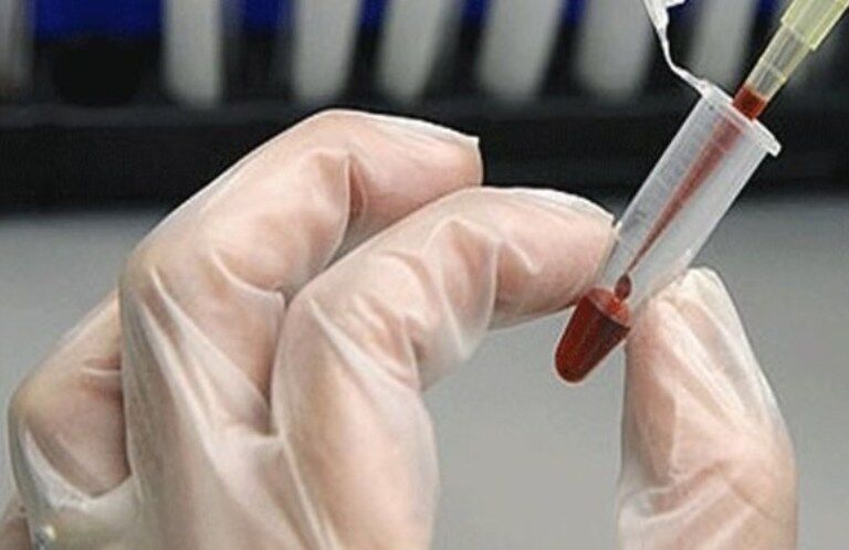 ۲۷ پیوند از نمونه‌های بانک خون بندناف انجام شده است