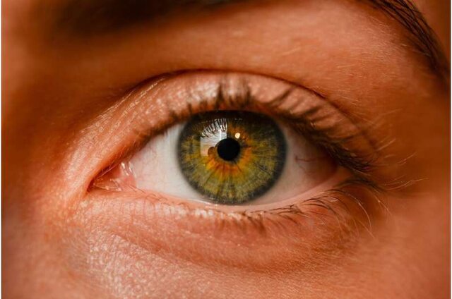 افراد دیابتی سالی یکبار تحت معاینه کامل چشم قرار گیرند