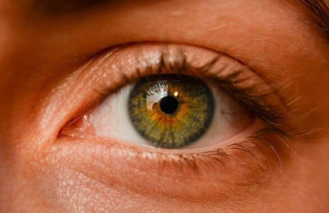 نقش ژنتیک در ابتلا به گلوکوم