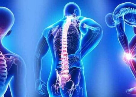 مشکلات جدی اسکلتی عضلانی با طب فیزیکی نوین قابل درمان است