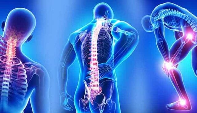 مشکلات جدی اسکلتی عضلانی با طب فیزیکی نوین قابل درمان است