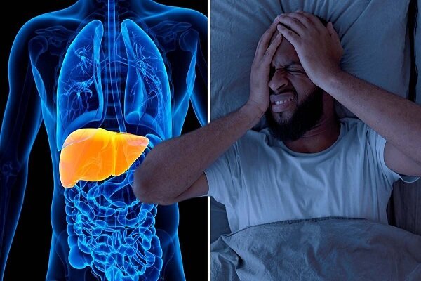 ۳ بیماری افزایش دهنده خطر مرگ ناشی از کبد چرب