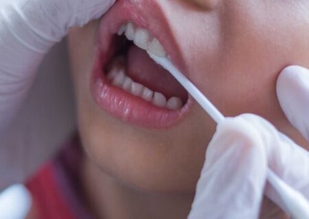 تأثیر رژیم غذایی مدیترانه‌ای بر کاهش التهاب لثه‌ها و بهبود سلامت دهان