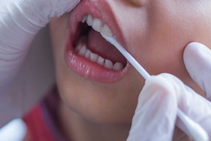 تأثیر رژیم غذایی مدیترانه‌ای بر کاهش التهاب لثه‌ها و بهبود سلامت دهان