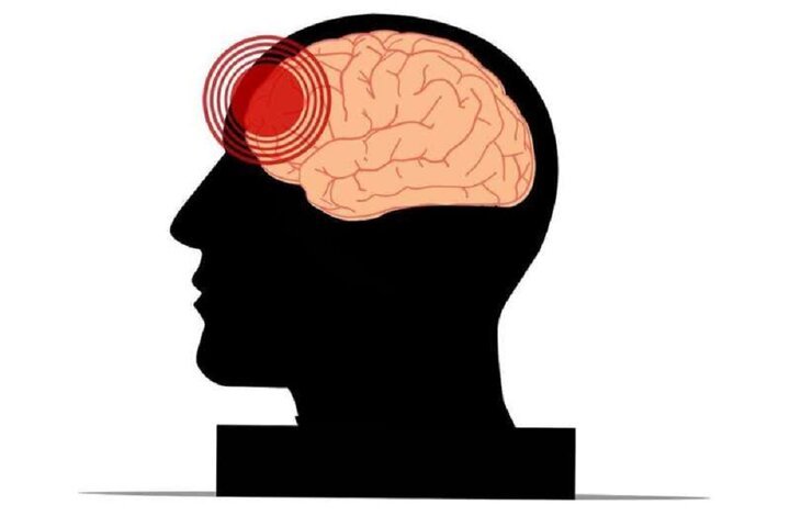 آسیبهای تروماتیک مغزی در افراد مسن با افزایش خطر زوال عقل مرتبط است
