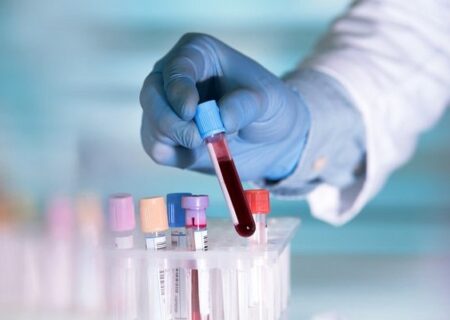 تاثیر آزمایش خون مبتنی بر DNA بر درمان سرطان گلو