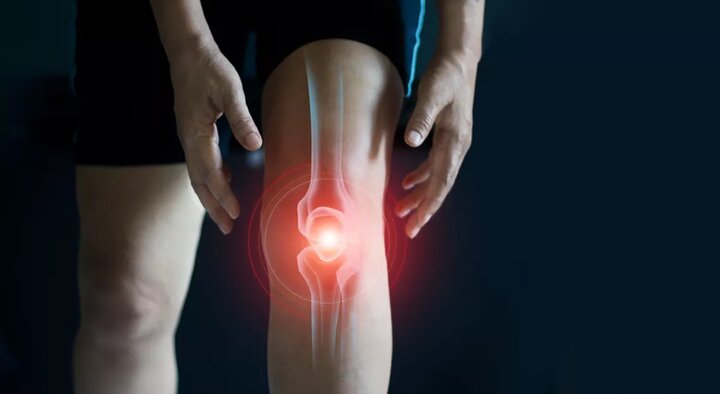 آنچه باید درباره زانوی پرانتزی و دردهای زانو بدانید