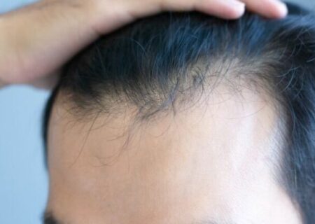 عارضه جانبی نگران‌کننده داروهای لاغری که هیچ‌کس در مورد آن صحبت نمی‌کند