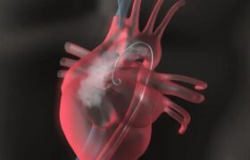 اولین جراحی رباتیک نقص مادرزادی قلب در جهان با هوش مصنوعی
